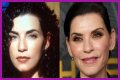 Julianna Margulies Doesn’t Look Natural After Plastic Surgery!
